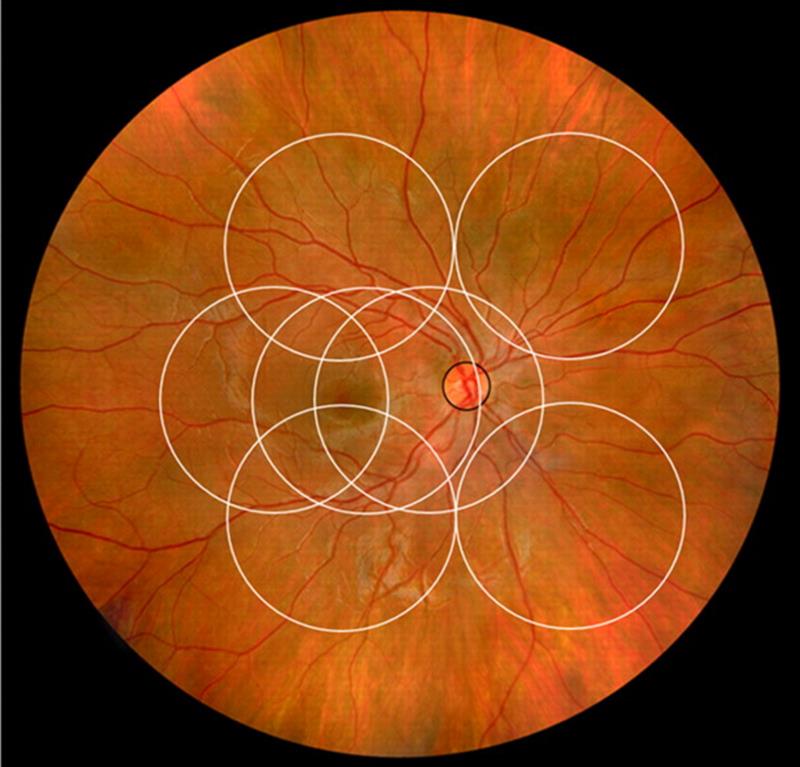 Optician